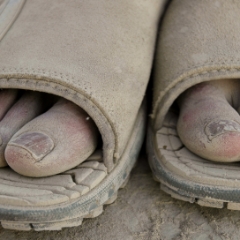 Bandaid toe